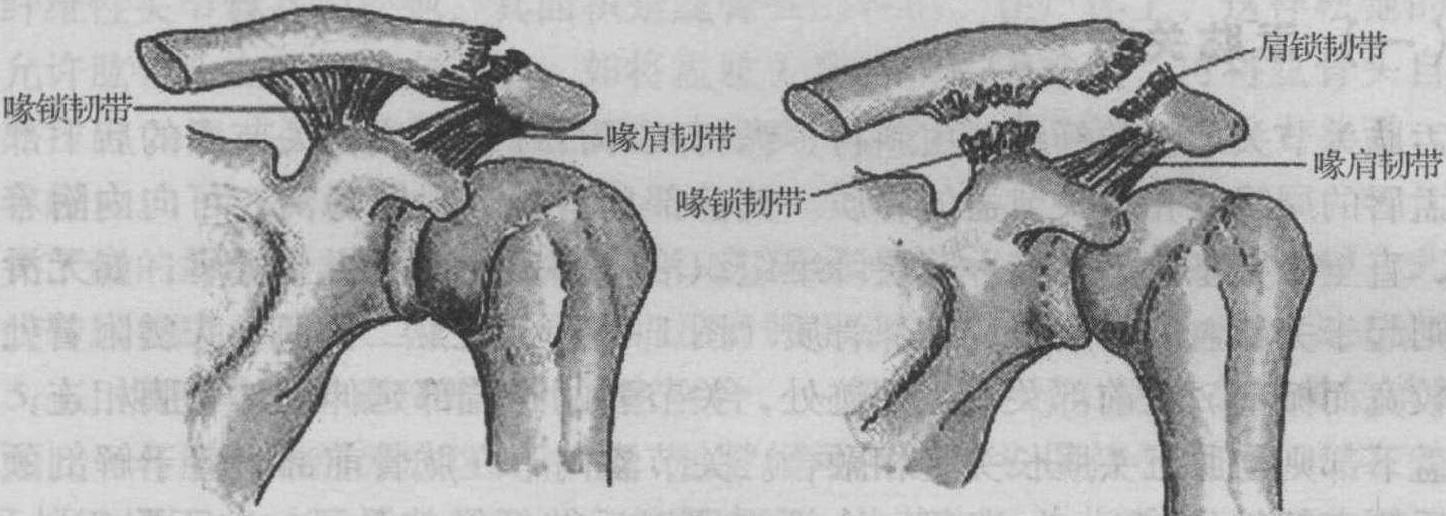 二、韌帶